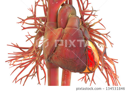 Human heart with left ventricle highlighted in red, 3D illustration. 134531846