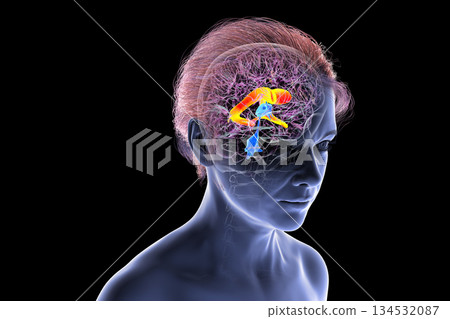 The lateral brain ventricles, 3D illustration 134532087