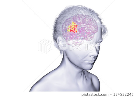 Human brain with highlighted precuneus gyrus, 3D illustration Human brain with highlighted precuneus gyrus, 3D illustration 134532245