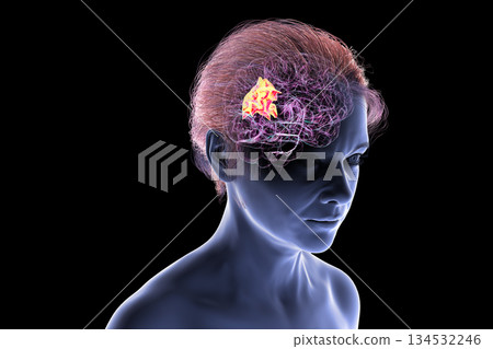 Human brain with highlighted precuneus gyrus, 3D illustration Human brain with highlighted precuneus gyrus, 3D illustration 134532246