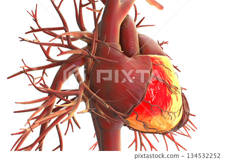 Human heart with right ventricle highlighted in red, 3D illustration. 134532252
