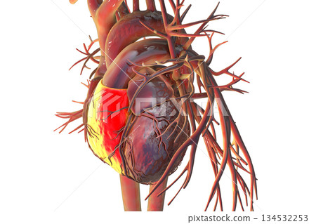 Human heart with right ventricle highlighted in red, 3D illustration. Human heart with right ventricle highlighted in red, 3D illustration. 134532253