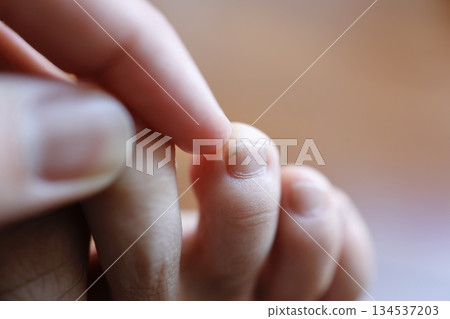 Close-up of a fingertip with black dirt on the toenail. Close-up of a fingertip with black dirt on the toenail. 134537203