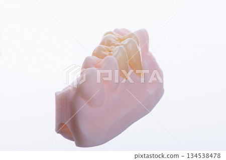 High-quality naturally dental single crowns made of zirconium for fixation to the teeth of upper jaw. 134538478