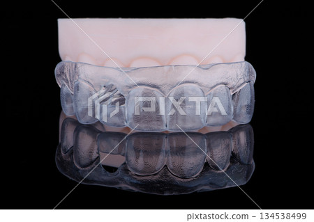 3D printed transparent dental template for gum correction fixed on model on black background. 134538499