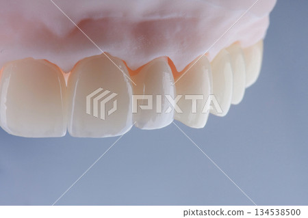 High-quality dental crowns made of zirconium for fixation to the teeth of upper jaw. 134538500