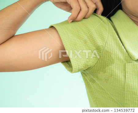 Woman Hyperhidrosis Wet Green shirt Underarm Hand Close Up. Problem Armpit Sweat Stains and Strong Body Odor,Hyperhidrosis Sweating,Hygiene for Good Health Concept,Sweaty Under Arm. 134539772