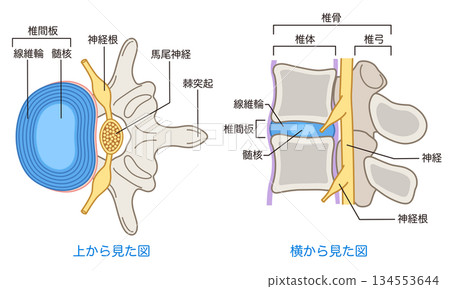 Structure of the lumbar disc: Lumbar disc herniation Structure of the lumbar disc: Lumbar disc herniation 134553644