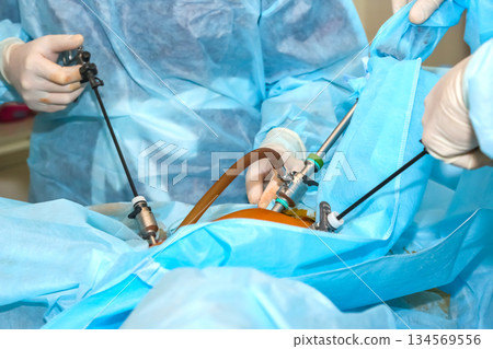 Surgical team performing minimally invasive procedure in an operating room setting 134569556