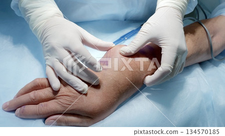 Russia Tomsk 05.07.2025: Team assessing hand for intravenous access, gloved clinicians palpating wrist veins near cannula site, sterile tubing visible, focused preparation for anesthesia Russia Tomsk 05.07.2025: Team assessing hand for intravenous access, gloved clinicians palpating wrist veins near cannula site, sterile tubing visible, focused preparation for anesthesia 134570185