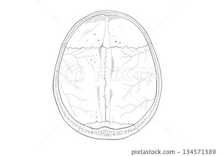 Cranial vault Cranial vault 134571389