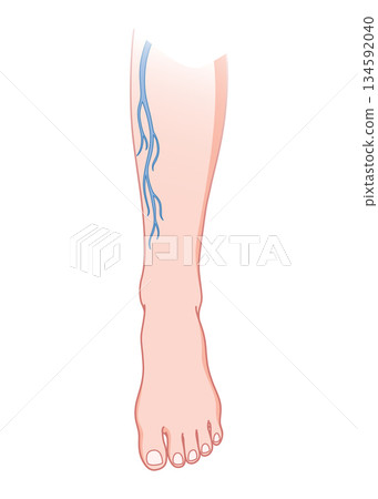 Varicose veins. Blue blood vessel visible through the skin, abnormally swollen leg. Vascular disease diagnostic and treatment. Venous insufficiency medical disease Varicose veins. Blue blood vessel visible through the skin, abnormally swollen leg. Vascular disease diagnostic and treatment. Venous insufficiency medical disease 134592040