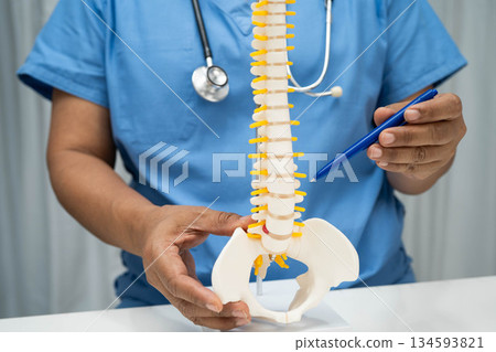 Asian doctor holding spinal nerve and bone model, Lumbar spine displaced herniated disc fragment for treatment medical in the orthopedic department. 134593821