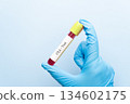 Doctor holding a test blood sample tube with CEA (Carcinoembryonic Antigen) test, tumor marker for colorectal cancer. 134602175