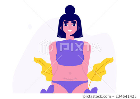 Women with cesarean scar. Stitches after caesarean section, C-section concept. Vector flat illustration isolated white background. 134641425