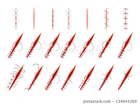 Suture icons set cartoon vector. Wound surgical Suture icons set cartoon vector. Wound surgical 134643269