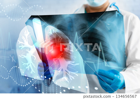 Doctor examines lung x-ray with highlighted area and heart monitor in healthcare setting Doctor examines lung x-ray with highlighted area and heart monitor in healthcare setting 134656567