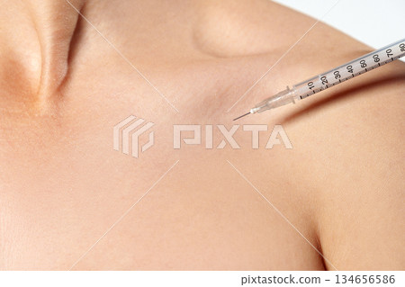 Needle insertion into shoulder area during medical procedure in a clinical setting Needle insertion into shoulder area during medical procedure in a clinical setting 134656586