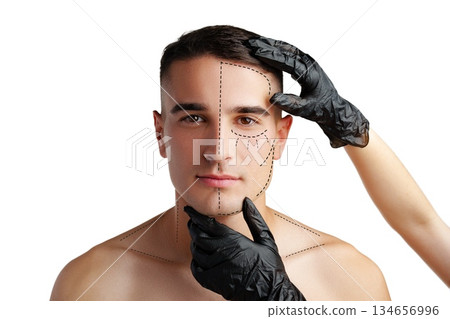 Man prepares for face treatment in medical setting with gloves and markings on skin 134656996