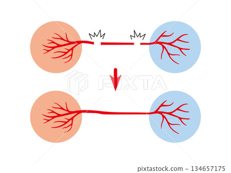 Easy-to-understand neuroregenerative medicine: Nerve regeneration revives nerves; natural healing, self-regeneration, and functional recovery 134657175
