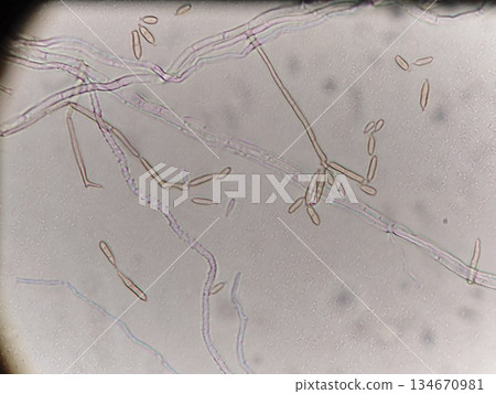 青黴菌分生孢子的形成 134670981