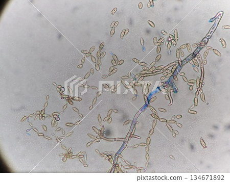 Mold growing in the environment 134671892