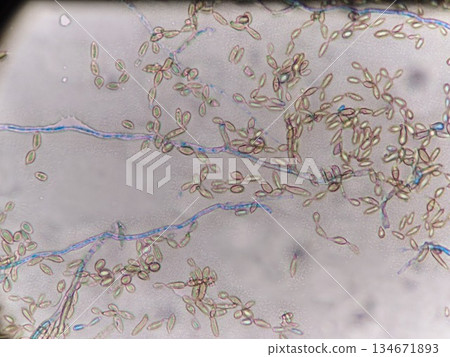 模具顯微照片 134671893