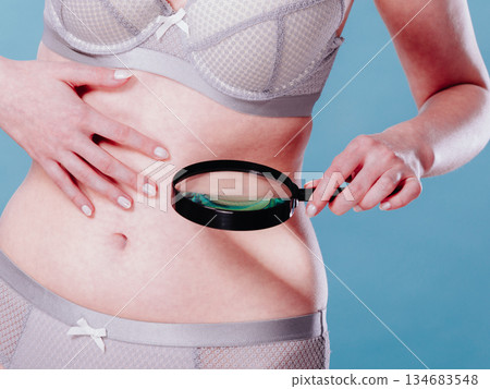 Woman using magnifying glass to examine her moles skin 134683548