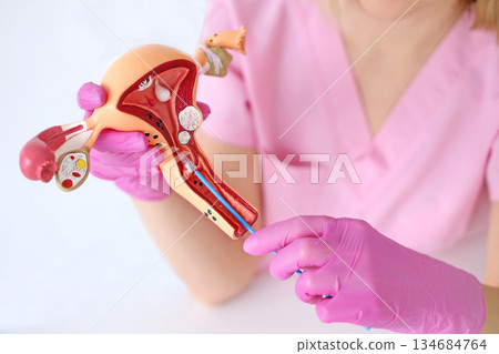 An anatomical model of the female uterus and a brush for taking a smear for cytological analysis in the hands of a female doctor An anatomical model of the female uterus and a brush for taking a smear for cytological analysis in the hands of a female doctor 134684764
