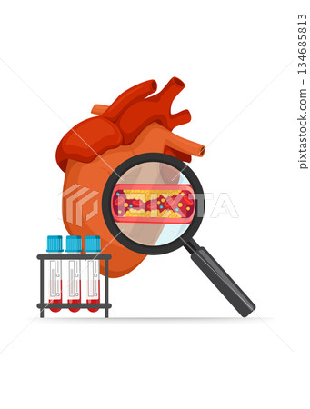 Cholesterol in human blood vessels and heart medical concept stock illustration Cholesterol in human blood vessels and heart medical concept stock illustration 134685813