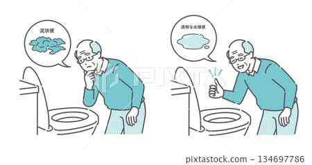 大腸鏡檢查前糞便狀況對照圖(老年男性,泥狀糞便不可接受,清澈水樣糞便可以接受) 大腸鏡檢查前糞便狀況對照圖(老年男性,泥狀糞便不可接受,清澈水樣糞便可以接受) 134697786