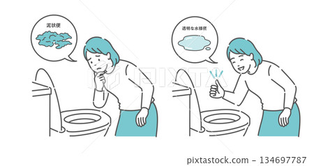Illustration of stool condition comparison before colonoscopy (women: muddy stools are not acceptable, clear watery stools are acceptable) 134697787