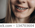 A girl with braces. Visit to the dentist. Beautiful smile 134703604