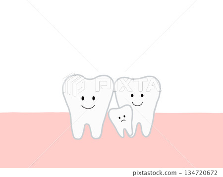 Illustration showing misalignment of teeth due to impacted or supernumerary teeth 134720672
