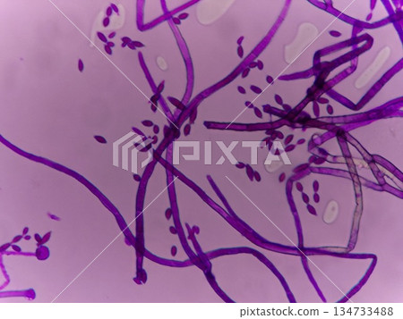 Stained mold mycelium 134733488
