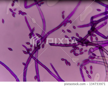 粗大的菌絲染成紫色 134733971