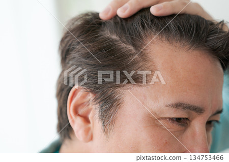 一位五十多歲男士的髮線特寫 一位五十多歲男士的髮線特寫 134753466