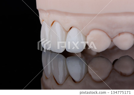 Four dental ultra-thin ceramic veneers in bleach color for fixation to frontal teeth of upper jaw. 134775171