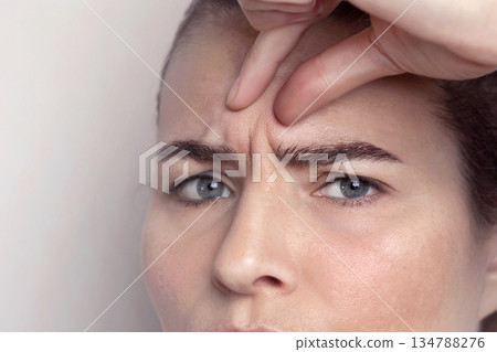 Glabellar lines, folds in a middle-aged woman with blue eyes. Woman dissatisfied with interforehead lines. Copy space Glabellar lines, folds in a middle-aged woman with blue eyes. Woman dissatisfied with interforehead lines. Copy space 134788276