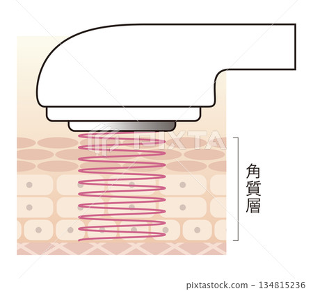 Cavitation facial beauty device 134815236