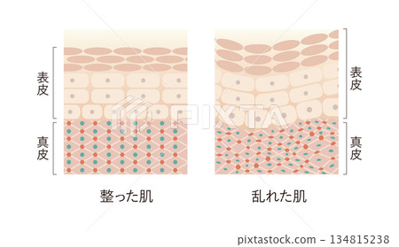 皮膚輪廓分明,但皮膚粗糙。 皮膚輪廓分明,但皮膚粗糙。 134815238