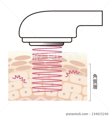 Cavitation facial beauty device 134815240