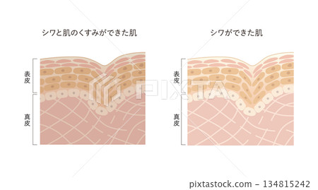 皺紋和暗沉 134815242