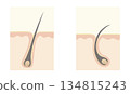 How hair grows 134815243