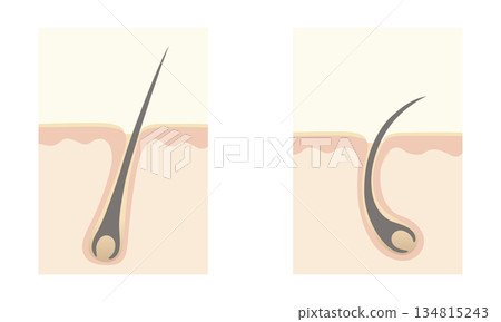 頭髮是如何生長的 134815243