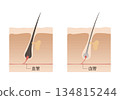 Healthy and thin hair 134815244
