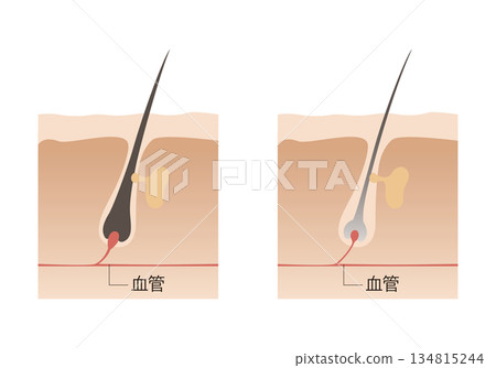 Healthy and thin hair Healthy and thin hair 134815244