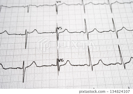 Red heart on electrocardiogram ECG with red heart, heart wave, heart attack, cardiogram report. Red heart on electrocardiogram ECG with red heart, heart wave, heart attack, cardiogram report. 134824107