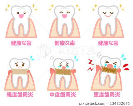 牙周疾病牙齦與牙齒插畫材料集 4 134832675