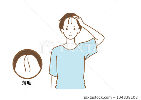 A man who is troubled with thinning hair 134839108